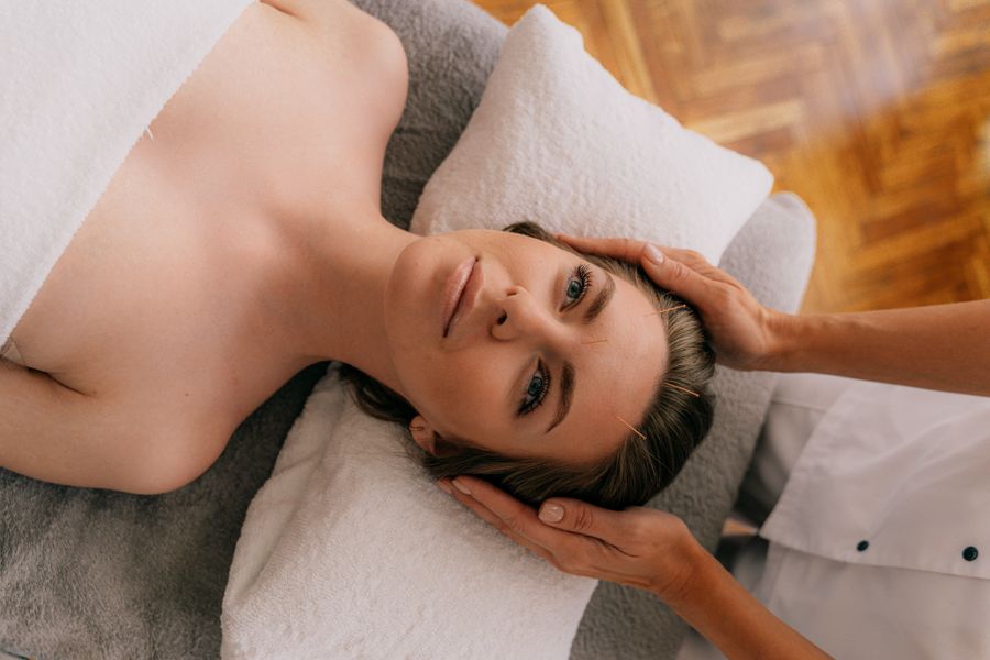 A person resting calmly during a gentle acupuncture treatment